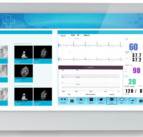 ADLINK MLC 5-21HE Medical AIO i7-5700EQ/8GB/128GB SSD *TouchScreen* *No Stand*