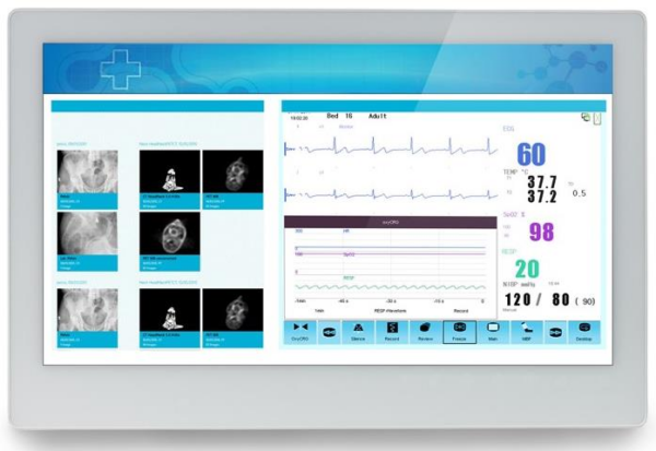 ADLINK MLC 5-21HE Medical AIO i7-5700EQ/8GB/128GB SSD *TouchScreen* *No Stand*