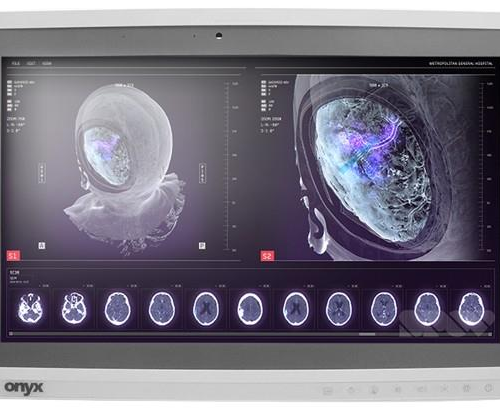 Onyx-Zeus-248 Professional Medical AIO i7-6600U/8GB/250GB SSD *TouchScreen* *No Stand*