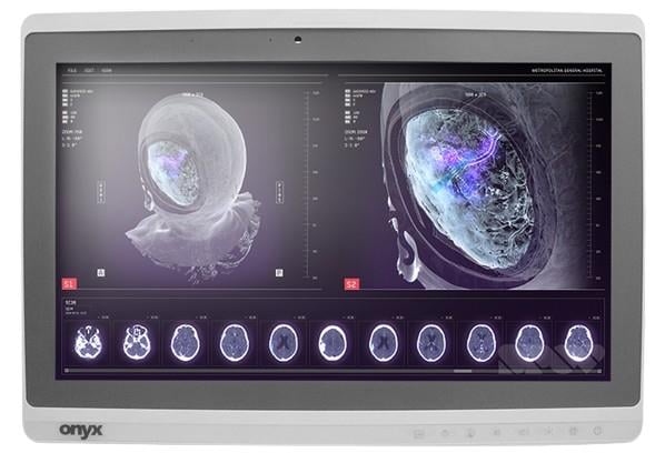 Onyx ZEUS-248 Medical AIO 24-inch touch computer